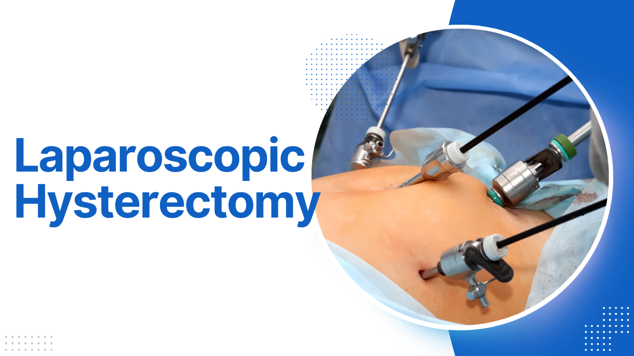 Laparoscopic Hysterectomy