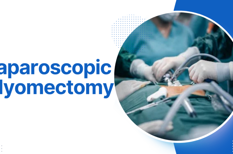 Laparoscopic Myomectomy