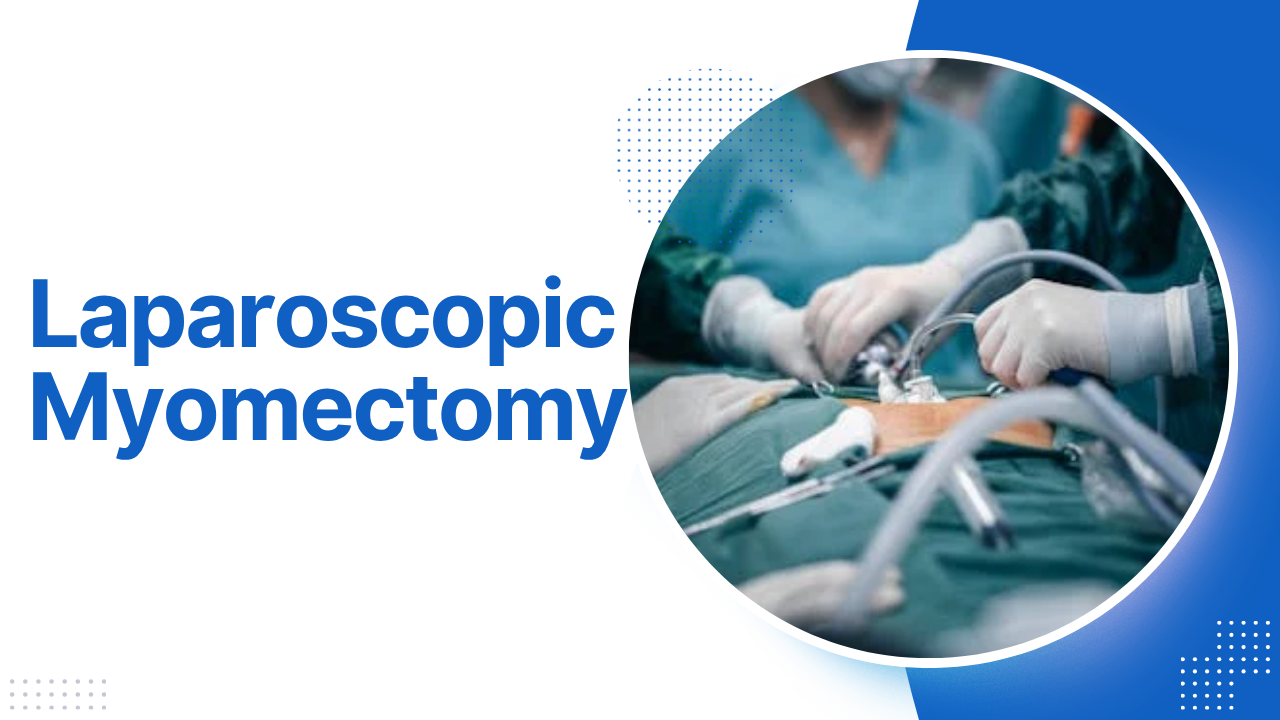 Laparoscopic Myomectomy