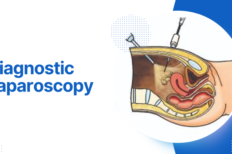 Diagnostic Laparoscopy