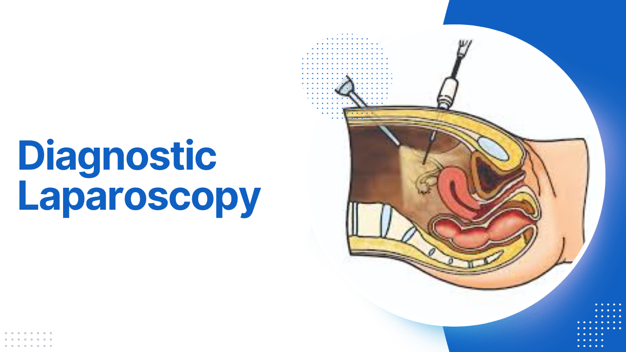 Diagnostic Laparoscopy