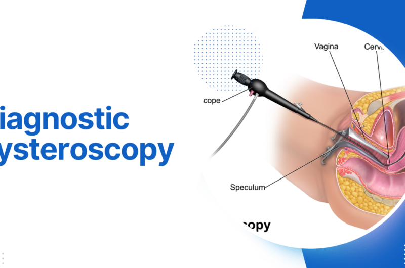 Diagnostic hysteroscopy
