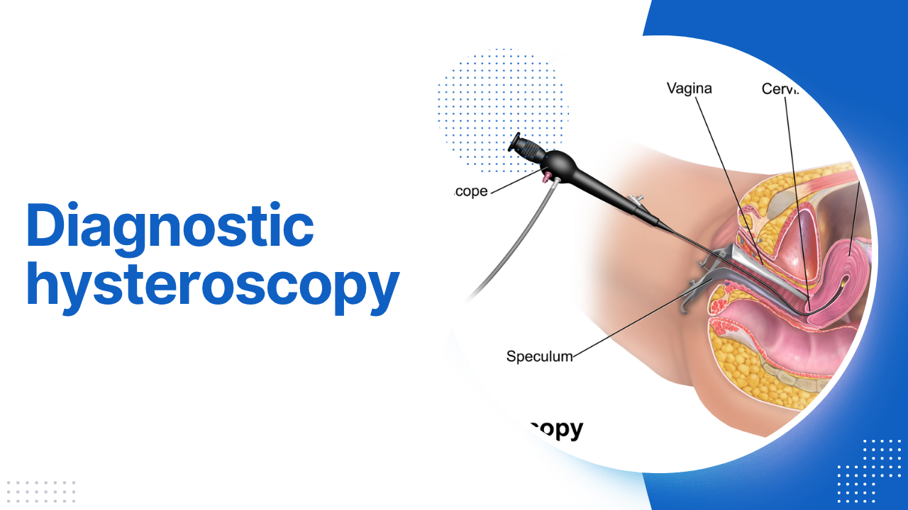 Diagnostic hysteroscopy