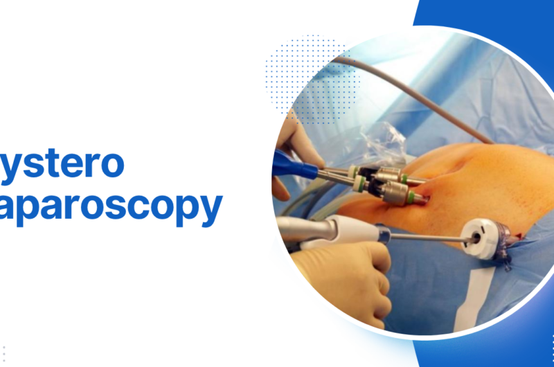 Hystero Laparoscopy
