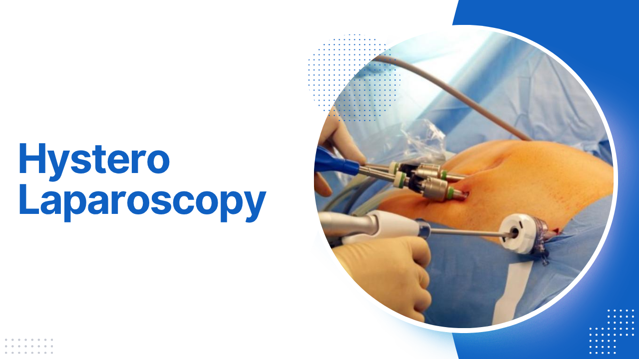 Hystero Laparoscopy