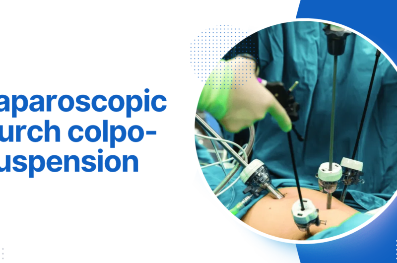 Laparoscopic Burch colpo-suspension