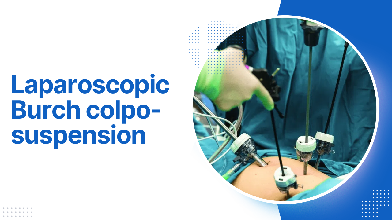 Laparoscopic Burch colpo-suspension