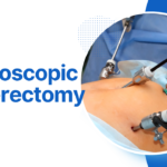 Existing RAGEC visual showing laparoscopic hysterectomy using minimally invasive instruments.