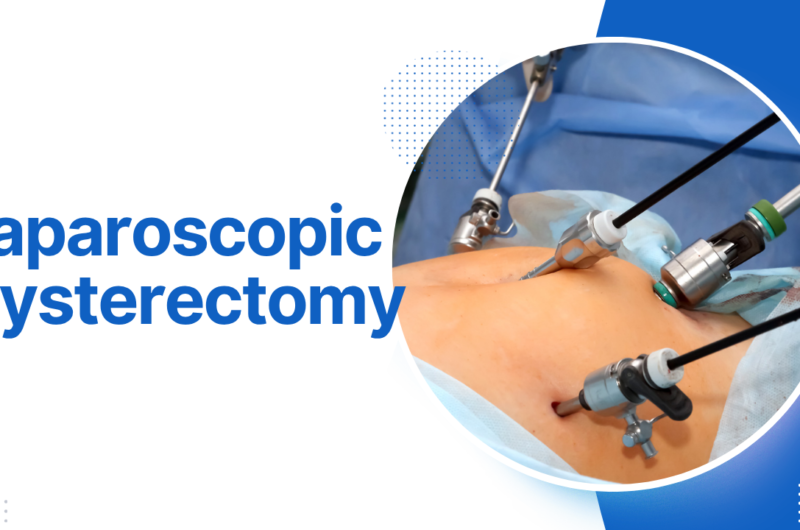 Laparoscopic Hysterectomy: Six Questions to Ask Your Gynecologist