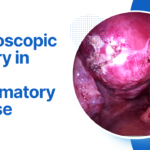 Existing RAGEC visual showing laparoscopic surgery in pelvic inflammatory disease.